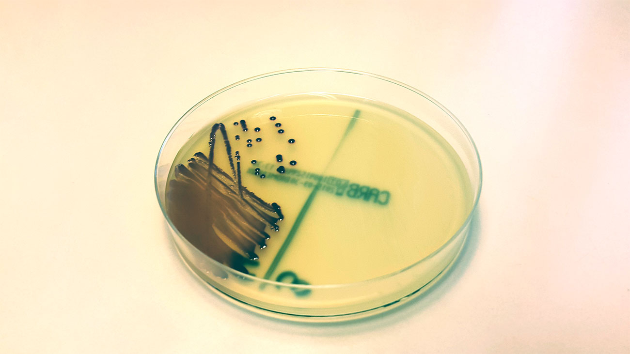 An agar plate with bacterial colonies